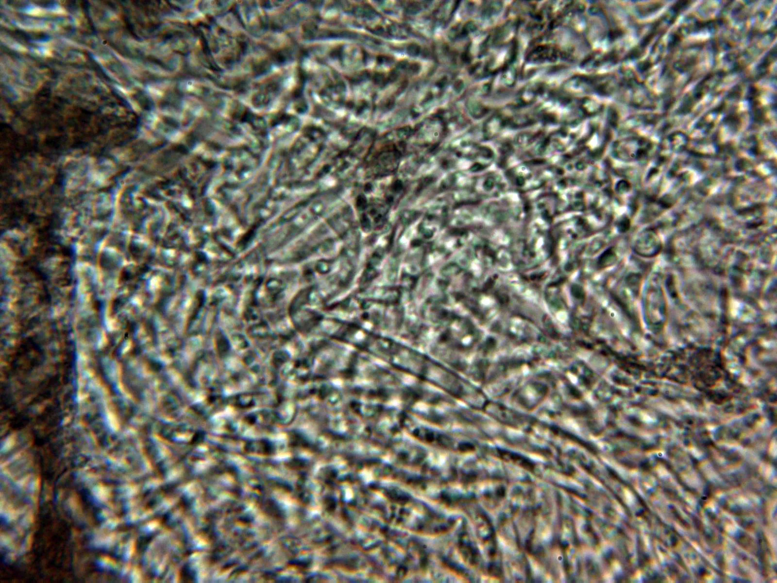 Microscopía de Neobulgaria koningiana - 11 - Hifas contexto 1